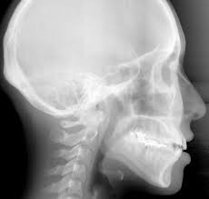 Dal 9 novembre i referti radiologici si consegnano on line